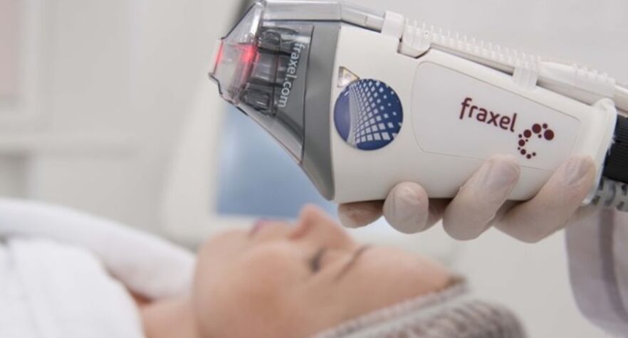 fractional skin rejuvenation machine