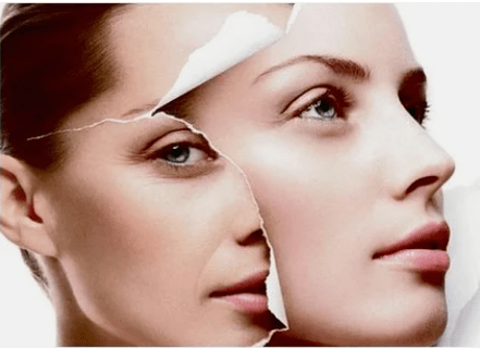 Contraindications procedure of the laser rejuvenation of the face