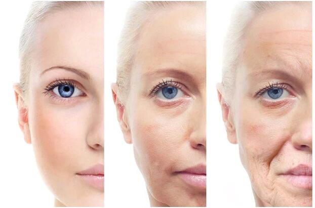 Laser of age -related facial changes