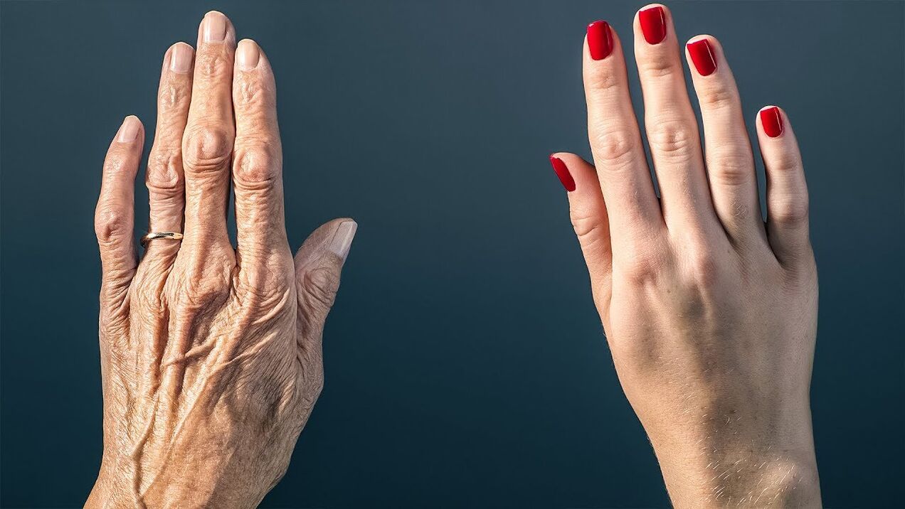 Effective ways to rejuvenate the skin of your hands.